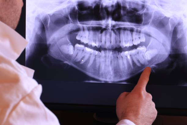 Best Walk-In Emergency Dentist in South Vacherie, LA
